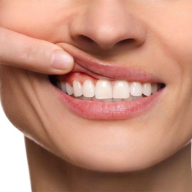 Cuidamos de tus encías en nuestra clínica dental