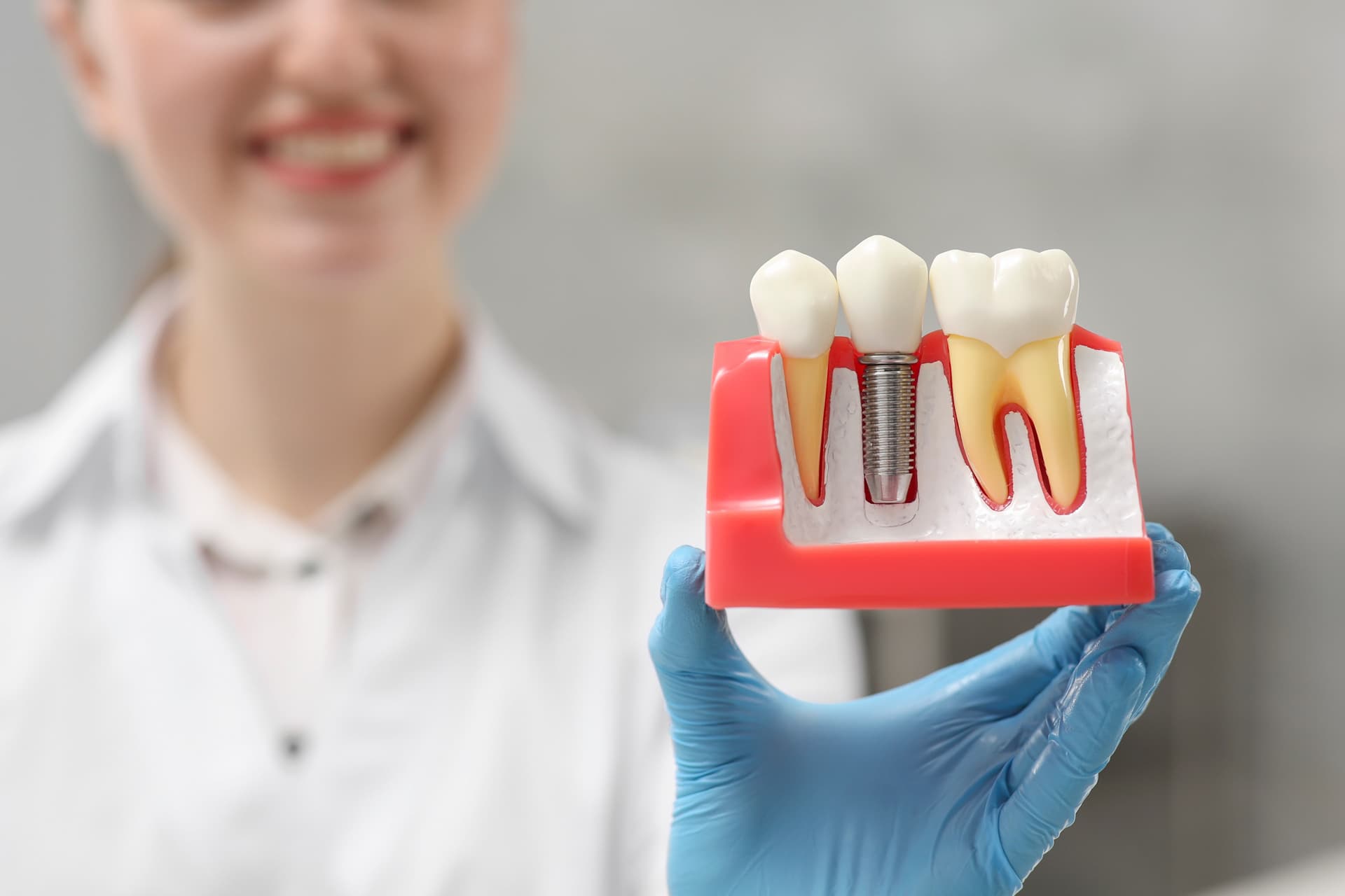 Implantes dentales en Narón