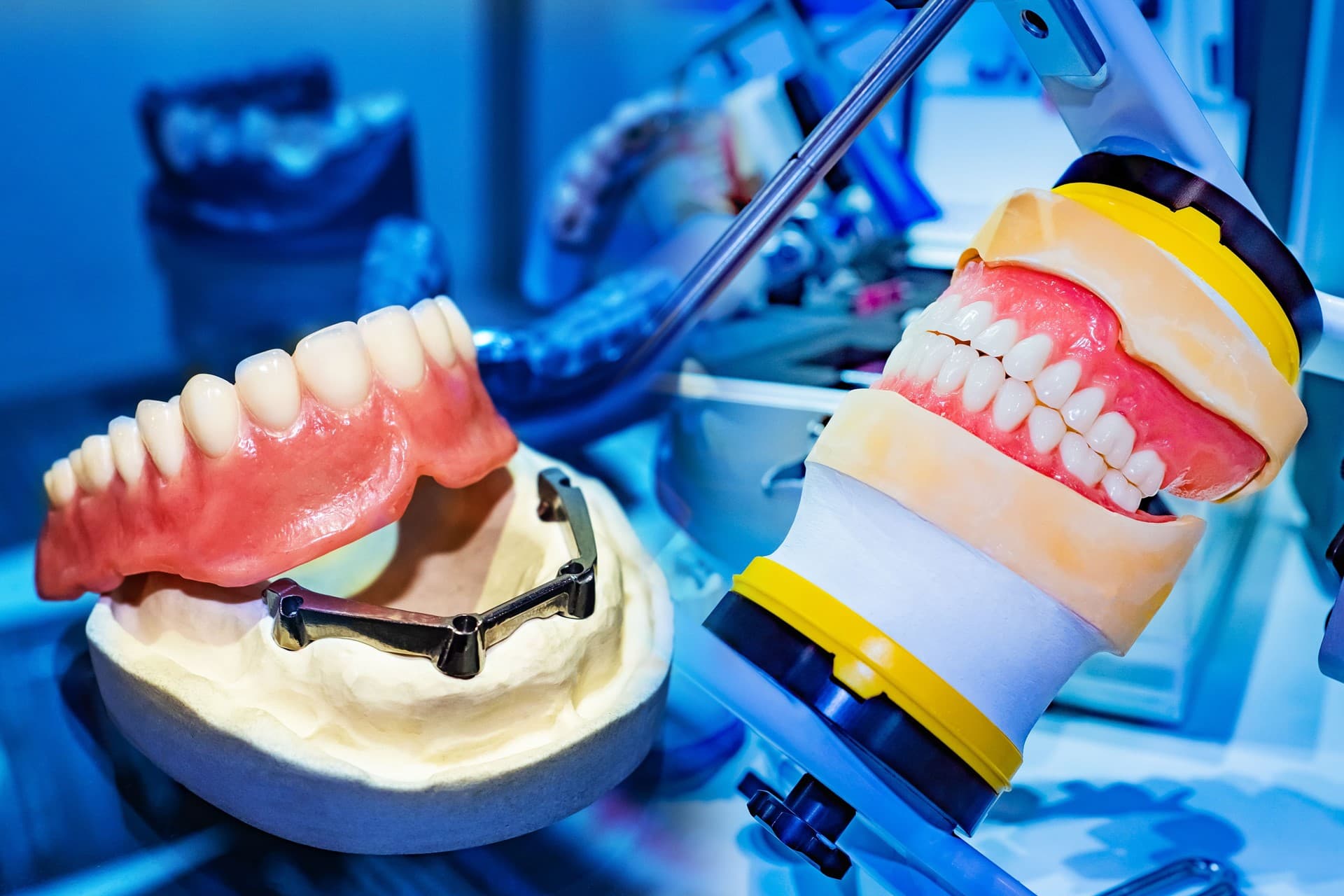 Implantología dental en Narón