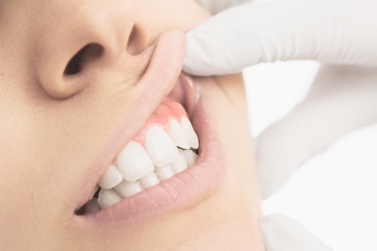 Servicios de prótesis dentales en Narón